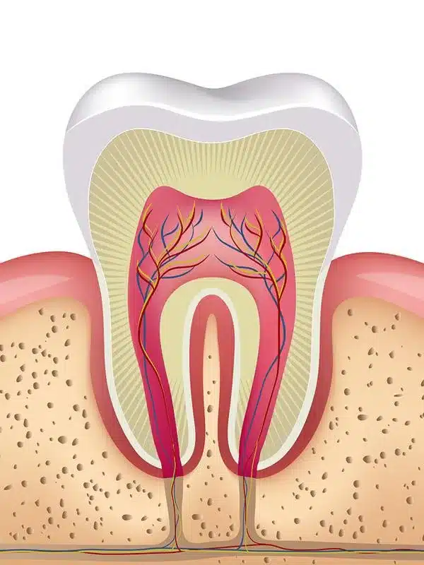 Anatomical cross-section diagram of tooth structure showing pulp, dentin, enamel, and gum tissue.
